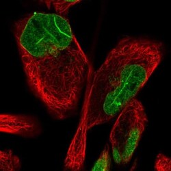 FAM135B Antibody, Novus Biologicals 25 &mu;L; Unlabeled:Antibodies, Polyclonal